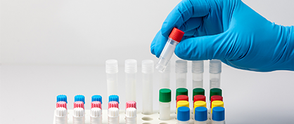 Quatre conseils pour prévenir le risque de contaminations croisées en laboratoire